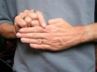 Baş Parmak Çıkığı Baş Parmağı Çıkığı Tedavisi Baş Parmak Çıkığı Baş Parmağı Çıkığı Tedavisi